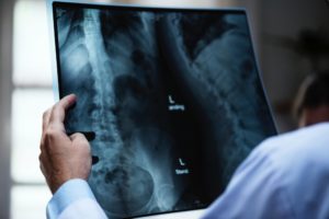 Medical Malpractice